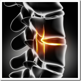 Slipped Disc Sewell NJ